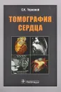 Томография сердца - С. К. Терновой