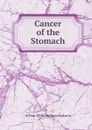 Cancer of the Stomach - Arthur William Mayo Robson