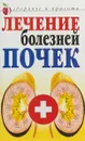 Лечение болезней почек - Романова Е.А.