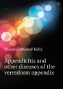 Appendicitis and other diseases of the vermiform appendix - Howard A. Kelly