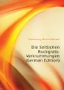 Die Seitlichen Ruckgrats-Verkrummungen (German Edition) - Eulenburg Moritz Michael