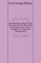 Photographic Atlas Of The Diseases Of The Skin With Descriptive Text, And A Treatise On Cutaneous Therapeutics - Fox George Henry