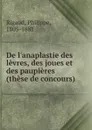 De l.anaplastie des levres, des joues et des paupieres - Philippe Rigaud