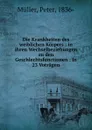 Die Krankheiten des weiblichen Korpers - Peter Müller