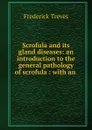 Scrofula and its gland diseases - Frederick Treves