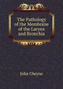 The Pathology of the Membrane of the Larynx and Bronchia - John Cheyne