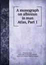A monograph on albinism in man. Atlas, Part 1 - Karl Pearson