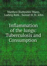 Inflammation of the lungs: Tuberculosis and Consumption . - Matthew Darbyshire Mann