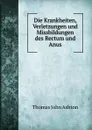 Die Krankheiten, Verletzungen und Missbildungen des Rectum und Anus - Thomas John Ashton