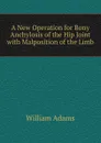 A New Operation for Bony Anchylosis of the Hip Joint with Malposition of the Limb - William Adams