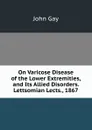 On Varicose Disease of the Lower Extremities, and Its Allied Disorders. Lettsomian Lects., 1867 - Gay John