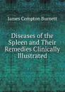 Diseases of the Spleen and Their Remedies Clinically Illustrated - James Compton Burnett