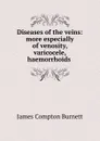 Diseases of the veins: more especially of venosity, varicocele, haemorrhoids . - James Compton Burnett