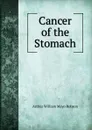 Cancer of the Stomach - Arthur William Mayo Robson