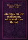An essay on the malignant, ulcerated sore throat - R. William