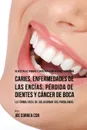86 Recetas de Comidas y Jugos Para Ayudarle A Prevenir Caries, Enfermedades de Las Encias, Perdida de Dientes y Cancer de Boca. La Forma Facil de Solucionar Sus Problemas - Joe Correa