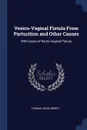Vesico-Vaginal Fistula From Parturition and Other Causes. With Cases of Recto-Vaginal Fistula - Thomas Addis Emmet