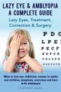 Lazy Eye . Amblyopia. Lazy eyes, treatment, correction and surgery. What is lazy eye, definition, causes in adults and children, symptoms, exercises. A complete guide. - Cameron Marr