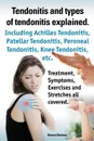 Tendonitis and the Different Types of Tendonitis Explained. Tendonitis Symptoms, Diagnosis, Treatment Options, Stretches and Exercises All Included. - Rowan Beetson