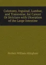 Colotomy, Inguinal, Lumbar, and Transverse, for Cancer Or Stricture with Ulceration of the Large Intestine - Herbert William Allingham