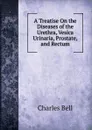 A Treatise On the Diseases of the Urethra, Vesica Urinaria, Prostate, and Rectum - Charles Bell