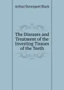 The Diseases and Treatment of the Investing Tissues of the Teeth - Arthur Davenport Black