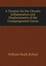 A Treatise On the Chronic Inflammation and Displacements of the Unimpregnated Uterus - William Heath Byford