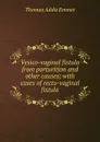 Vesico-vaginal fistula from parturition and other causes; with cases of recto-vaginal fistula - Thomas Addis Emmet