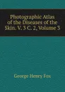 Photographic Atlas of the Diseases of the Skin. V. 3 C. 2, Volume 3 - George Henry Fox