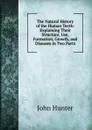 The Natural History of the Human Teeth: Explaining Their Structure, Use, Formation, Growth, and Diseases in Two Parts - Hunter John