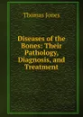 Diseases of the Bones: Their Pathology, Diagnosis, and Treatment - Thomas Jones