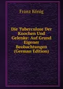 Die Tuberculose Der Knochen Und Gelenke: Auf Grund Eigener Beobachtungen (German Edition) - Franz König