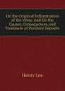 On the Origin of Inflammation of the Veins: And On the Causes, Consequences, and Treatment of Purulent Deposits - Henry Lee