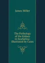 The Pathology of the Kidney in Scarlatina: Illustrated by Cases - James Miller