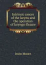 Intrinsic cancer of the larynx and the operation of laryngo-fissure - Irwin Moore