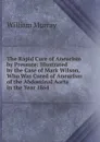 The Rapid Cure of Aneurism by Pressure: Illustrated by the Case of Mark Wilson, Who Was Cured of Aneurism of the Abdominal Aorta in the Year 1864 - William Murray
