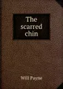 The scarred chin - Will Payne