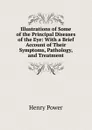 Illustrations of Some of the Principal Diseases of the Eye: With a Brief Account of Their Symptoms, Pathology, and Treatment - Henry Power