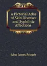 A Pictorial Atlas of Skin Diseases and Syphilitic Affections . - John James Pringle