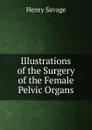 Illustrations of the Surgery of the Female Pelvic Organs - Henry Savage