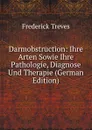 Darmobstruction: Ihre Arten Sowie Ihre Pathologie, Diagnose Und Therapie (German Edition) - Frederick Treves