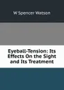 Eyeball-Tension: Its Effects On the Sight and Its Treatment - W Spencer Watson