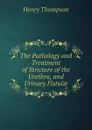 The Pathology and Treatment of Stricture of the Urethra, and Urinary Fistulae - Henry Thompson