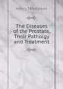 The Diseases of the Prostate, Their Patholgy and Treatment - Henry Thompson
