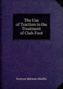 The Use of Traction in the Treatment of Club-Foot - Newton Melman Shaffer