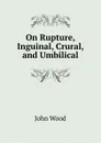 On Rupture, Inguinal, Crural, and Umbilical - John Wood