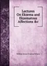 Lectures On Ekzema and Ekzematous Affections .c - William James Erasmus Wilson