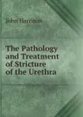 The Pathology and Treatment of Stricture of the Urethra - John Harrison