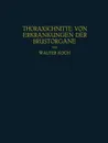 Thoraxschnitte Von Erkrankungen Der Brustorgane. Ein Atlas - Walter Koch