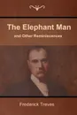 The Elephant Man and Other Reminiscences - Frederick Treves